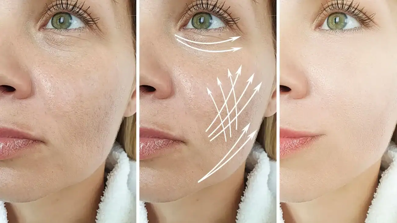 Can One Treatment Really Tackle More Than One Skin Concern Northamptonshire?