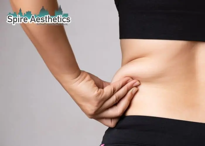 Image of woman pinching fat on their hips Northamptonshire. Fat Freezing treatment