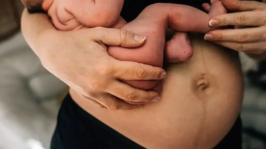 Why Is My Stomach Still Big After Pregnancy Northamptonshire?